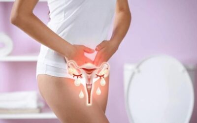 Qué es la Candidiasis Vaginal